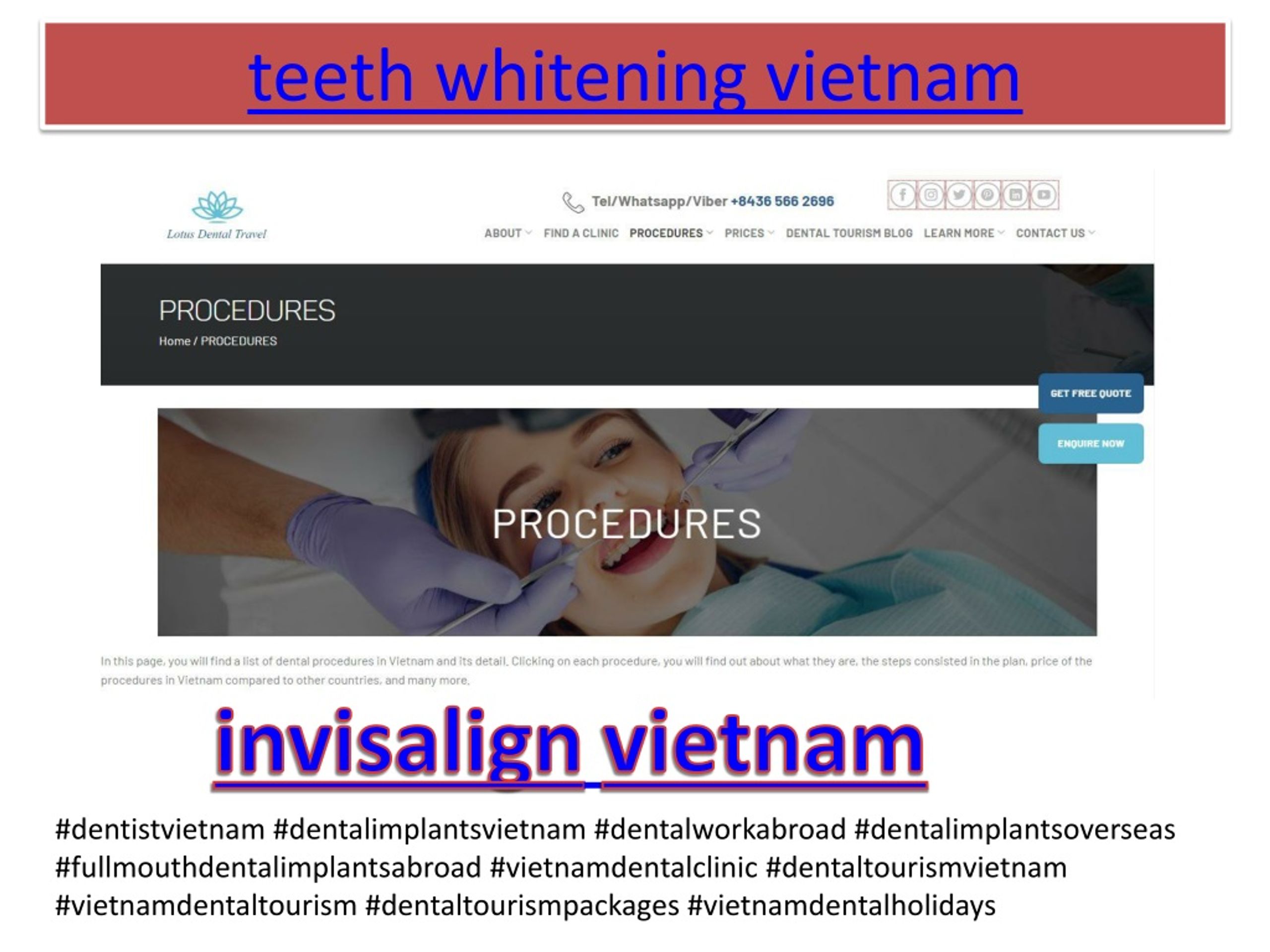 PPT vietnamese dentist PowerPoint Presentation, free download ID9263803