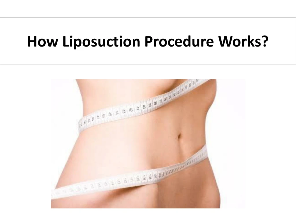 how liposuction procedure works n.