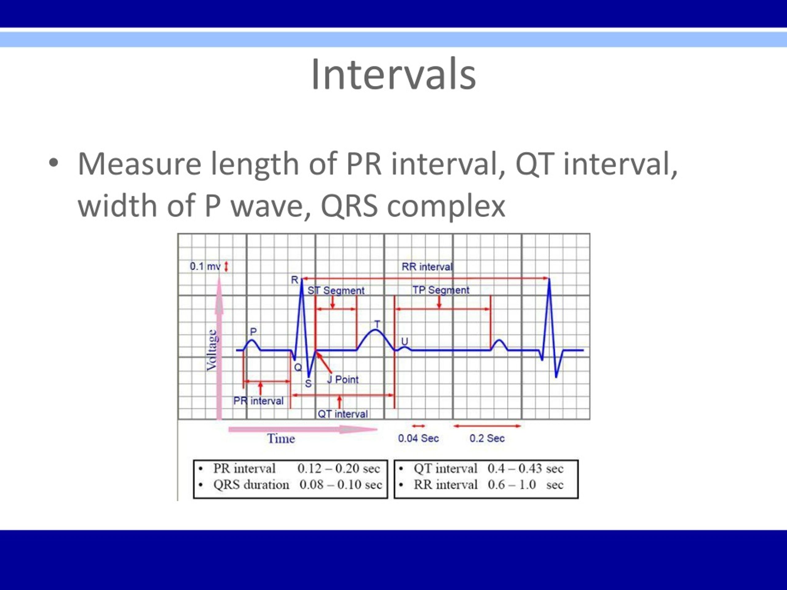 normal qt interval