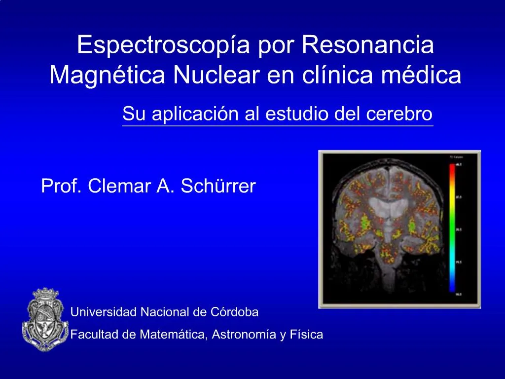 Ppt Espectroscop A Por Resonancia Magn Tica Nuclear En Cl Nica M Dica Powerpoint Presentation